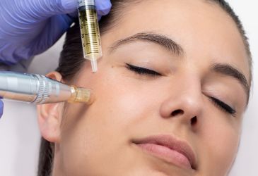 sin título (365 x 250 px) (11) sin título (365 x 250 px) (11)