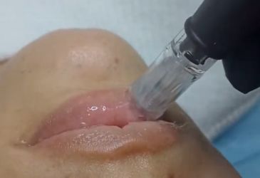 sin título (365 x 250 px) (26)