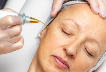 sin título (365 x 250 px) (9)